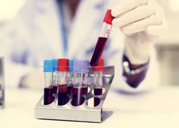 Come vivere più a lungo? Il test del sangue svela la longevità