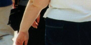 Una morte per malattie infettive su 10 è legata all’obesità, lo studio